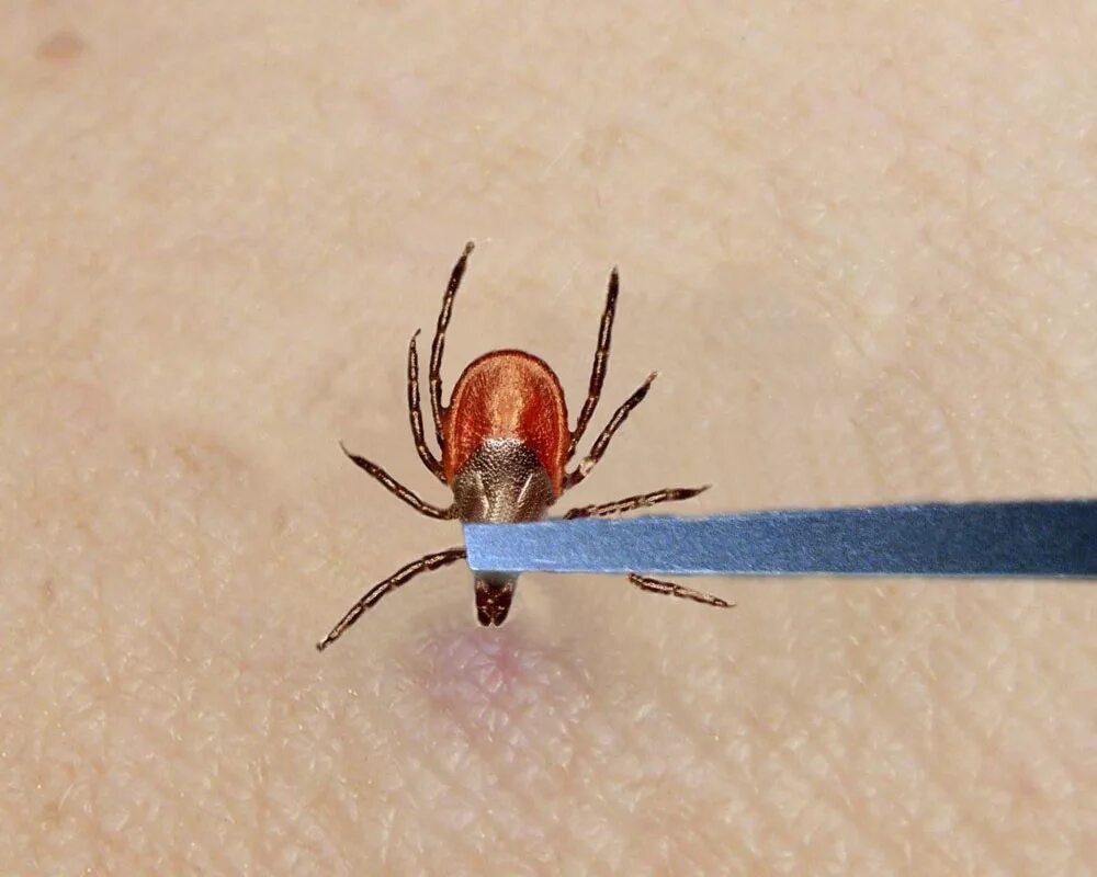 Присасывание клеща фото Tick Removal - Cooperative Extension: Tick Lab - University of Maine Cooperative