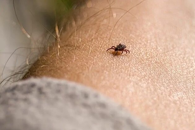 Присосавшийся клещ на коже человека фото Pfizer continues research to develop vaccine to address tick-borne diseases, suc