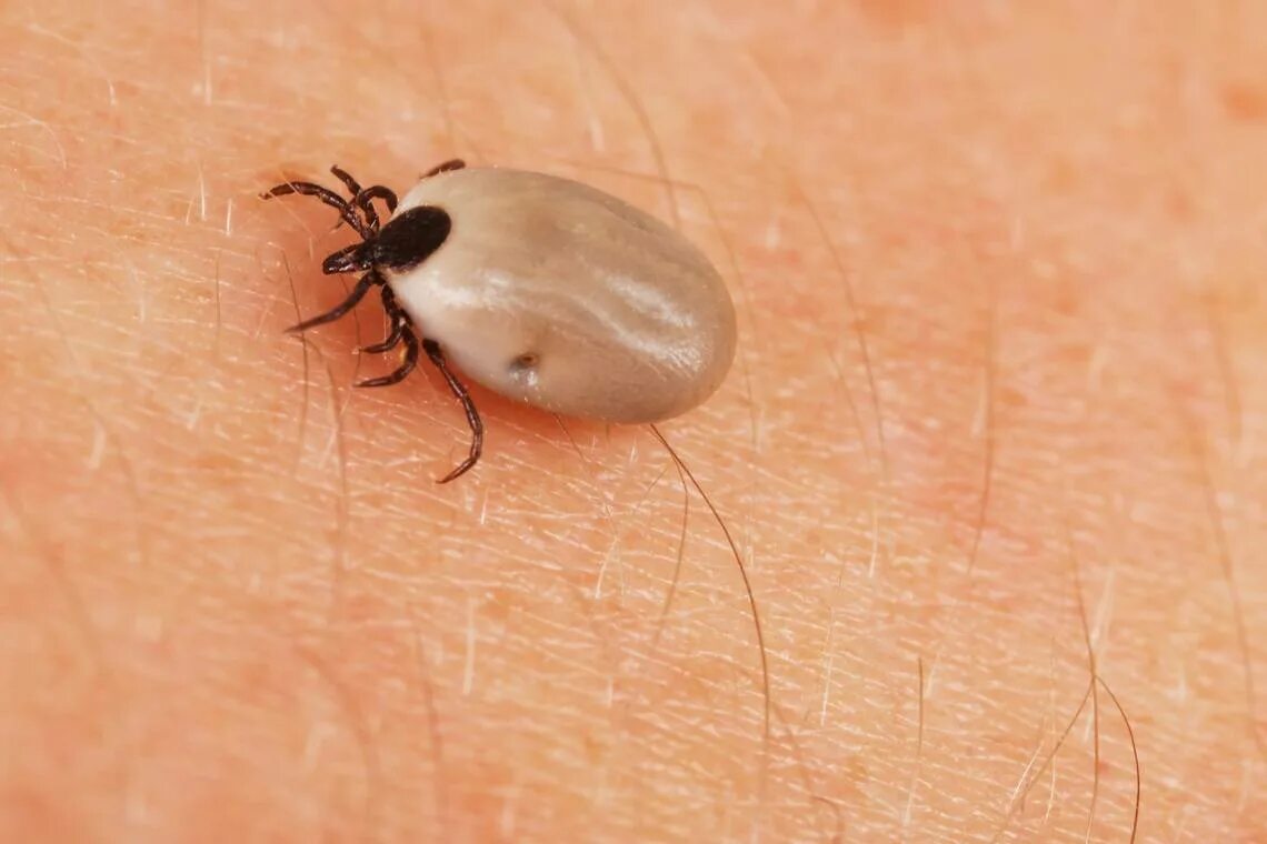 Присосавшийся клещ на коже человека фото Are ticks a threat to people in Texas? Here’s what experts say are diseases to w