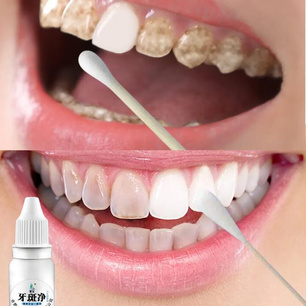 Пристли налет на зубах фото 10ml Teeth Whitening Clean Tooth Teeth Whitening Water Dental Charcoal Teeth Whi