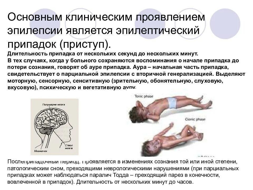 Приступ эпилепсии у кошки как выглядит Что чувствуют во время эпилепсии: найдено 76 картинок