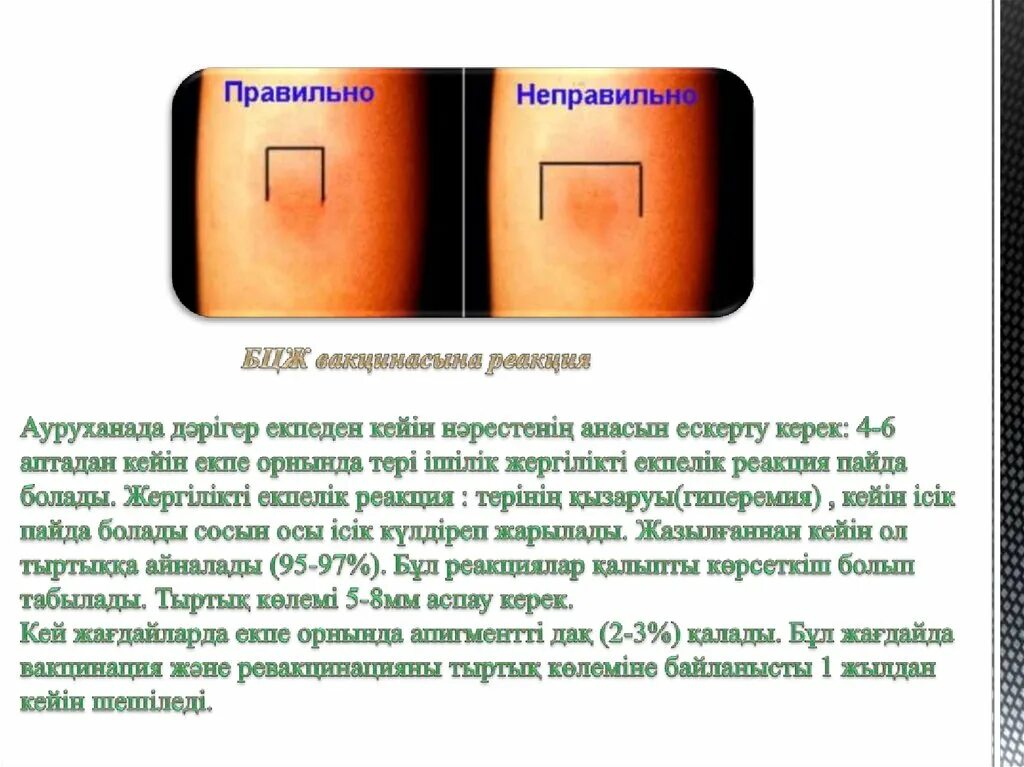 Прививка бцж фото по месяцам БЦЖ (вакцинасы жәнеревакцинация) - презентация онлайн