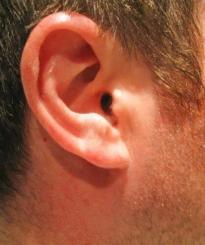 Признак франка на мочке уха фото Ear - Right - 104/365 Ear cleaning wax, Ear wax removal, Cleaning ears with pero