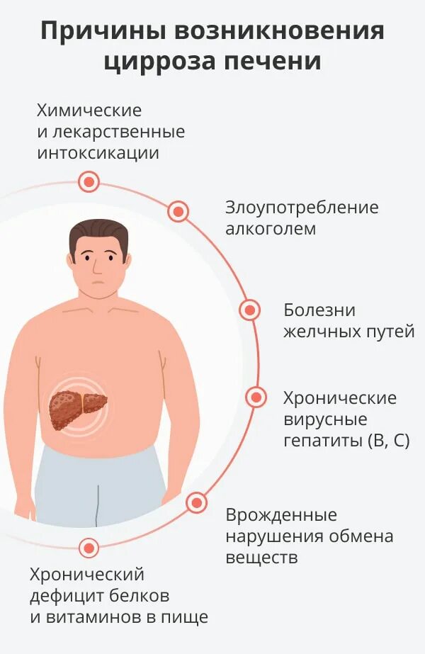 Признаки болезни печени фото Цирроз печени у мужчин: причины и признаки проявления