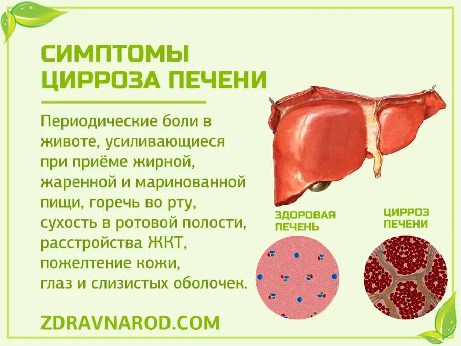 Признаки болезни печени фото Цирроз печени Народная медицина