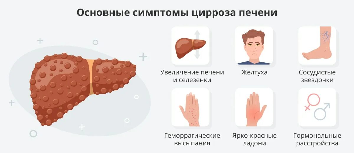 Признаки болезни печени фото Цирроз печени: причины, признаки, симптомы и лечение