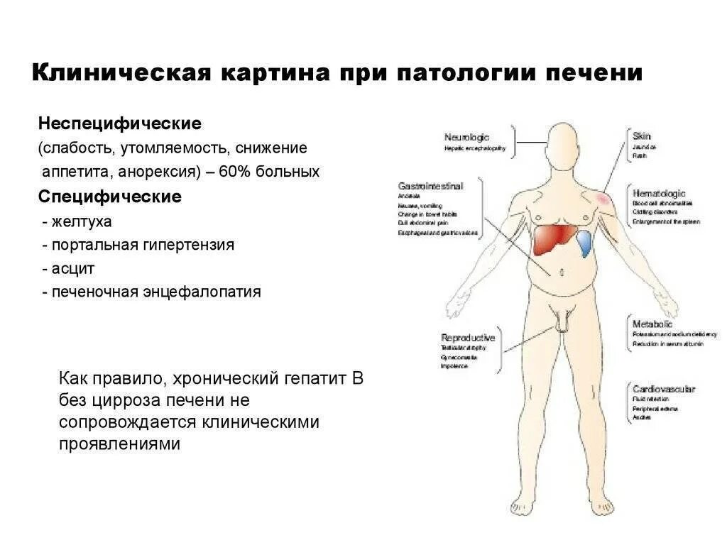 Признаки болезни печени фото Симптомы какого заболевания могут быть боль - найдено 90 картинок