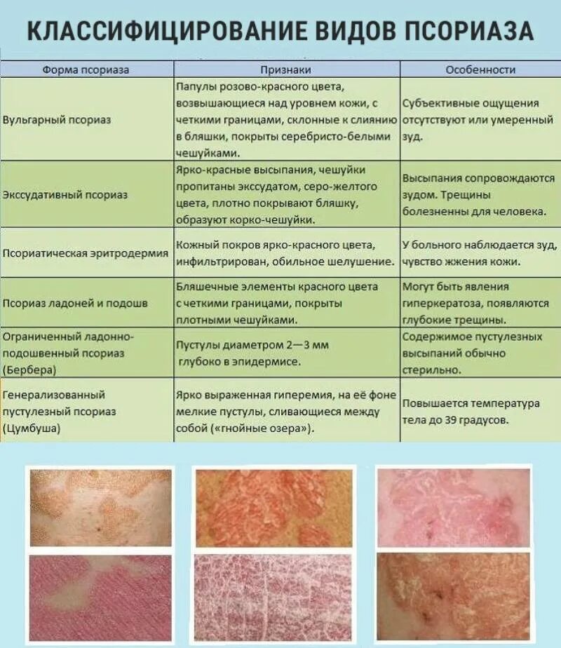 Признаки дерматита фото Симптомы заболеваний кожи