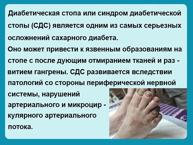 Признаки диабетической стопы фото симптомы Диабетическая стопа лечение препараты