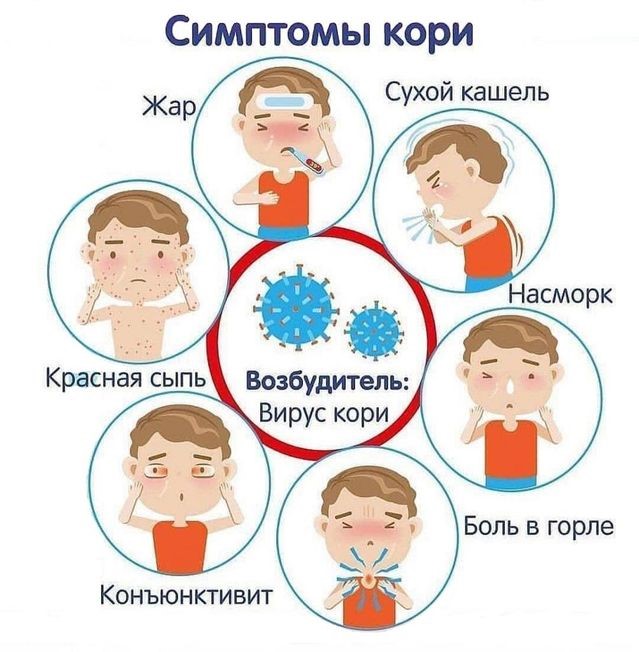 Признаки кори симптомы взрослых фото О КОРИ И ЕЁ ПРОФИЛАКТИКЕ - Учреждение здравоохранения "Центральная городская сто