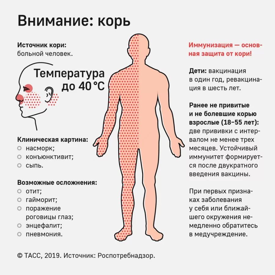 Признаки кори симптомы взрослых фото Осторожно! Корь! - Новости - Администрация Орджоникидзевского района