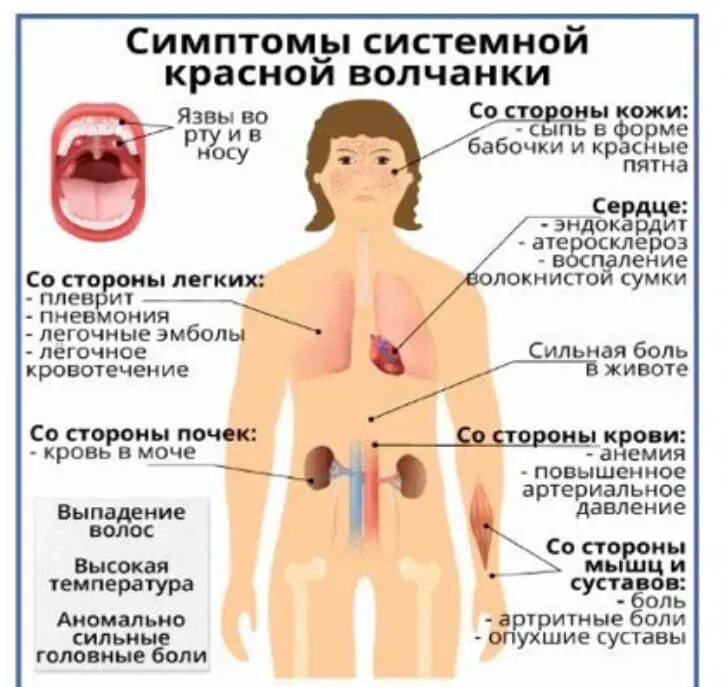 Признаки красной волчанки у женщин фото Волчанка и беременность