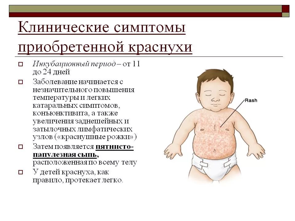 Признаки краснухи у детей фото начальной стадии Как лечит краснуху у детей: возбудители, симптомы, инкубационный период, фото