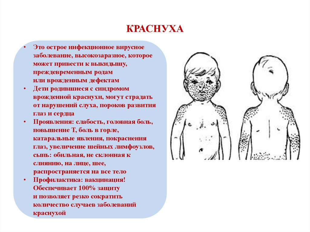 Признаки краснухи у взрослых фото симптомы Появляются характерные симптомы