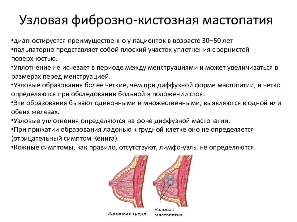 Признаки мастопатии у женщин симптомы фото Рентгенологическая картина фиброзно кистозной мастопатии