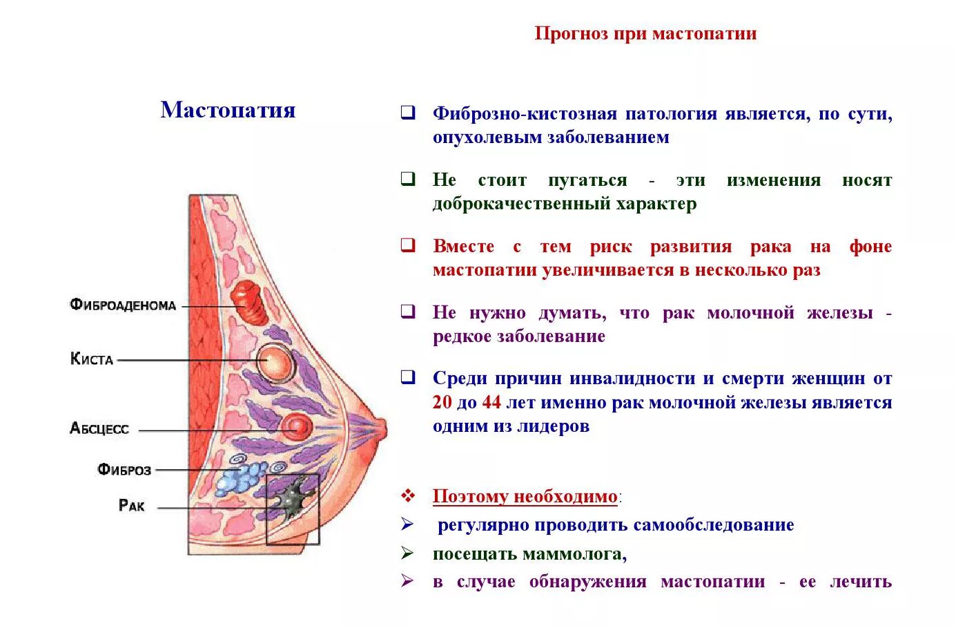 Признаки мастопатии у женщин симптомы фото Картинки МОЖНО ВЫЛЕЧИТЬ ФИБРОЗНУЮ МАСТОПАТИЮ