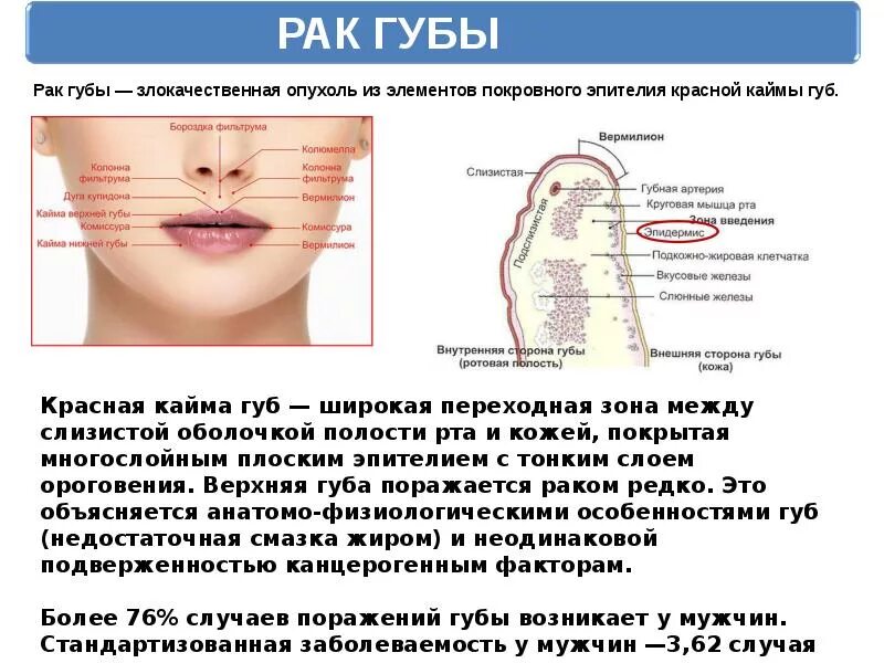 Признаки рака губы симптомы и фото Рак губы симптомы первые признаки - Арт Минск.ру