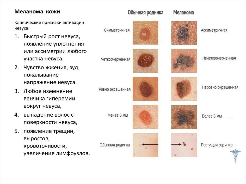 Признаки рака кожи у мужчин симптомы фото Общеевропейская компания "Евромеланома-2022") / Информация Центра здоровья - Пол