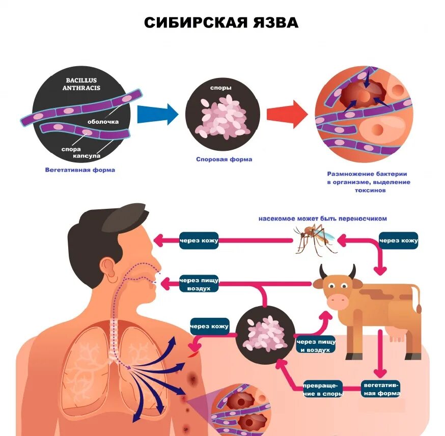 Признаки сибирской язвы фото Профилактика сибирской язвы