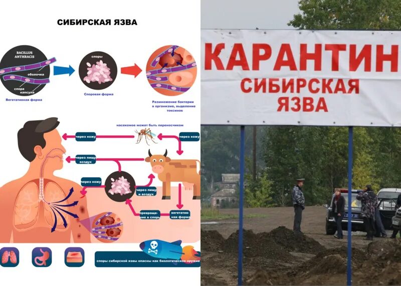 Признаки сибирской язвы фото Сибирская язва и меры профилактики. МБДОУ "Детский сад "Солнышко" Мариинско-Поса