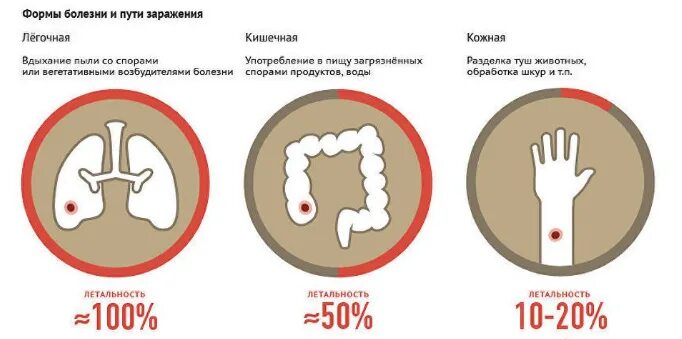 Признаки сибирской язвы у человека фото Сибирская язва: что это, как передается, как протекает, методы лечения