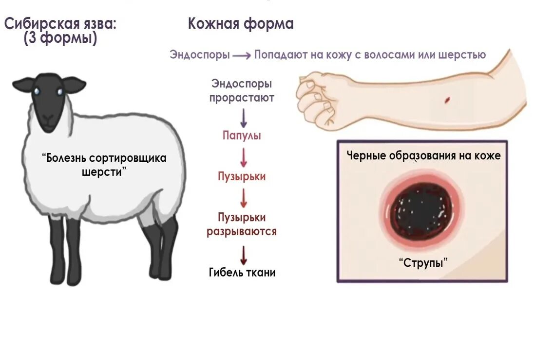 Признаки сибирской язвы у человека фото ОСТОРОЖНО, СИБИРСКАЯ ЯЗВА! МЕРЫ ПРЕДУПРЕЖДЕНИЯ И ЗАЩИТЫ