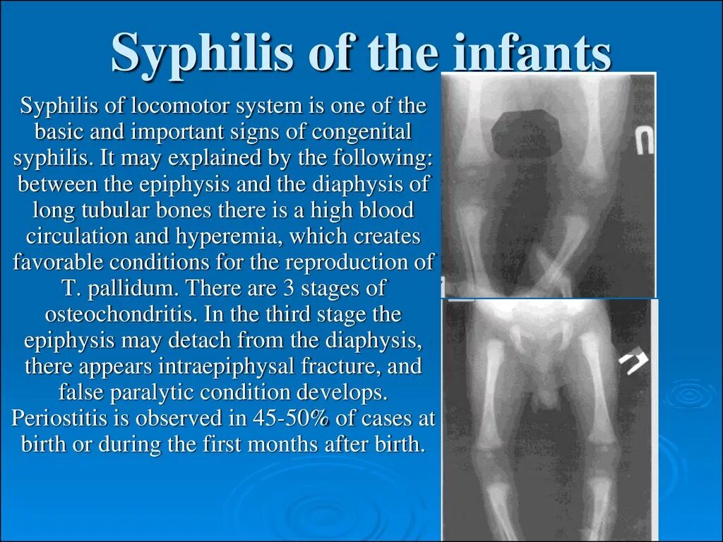 Признаки сифака у мужчин симптомы фото Tertiary, visceral syphilis, neurosyphilis - презентация онлайн