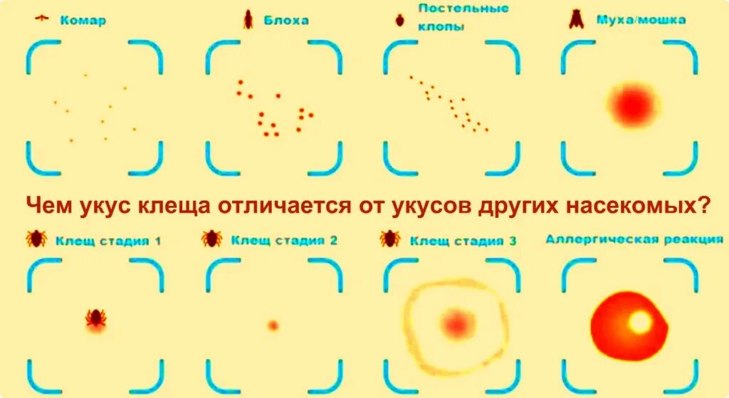 Признаки укусов клопов у человека фото Как кусает клоп схема