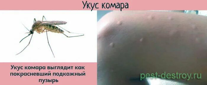 Признаки укусов клопов у человека фото Укусы клопа или укусы другого насекомого? Чем отличаются? - Уничтожение вредител