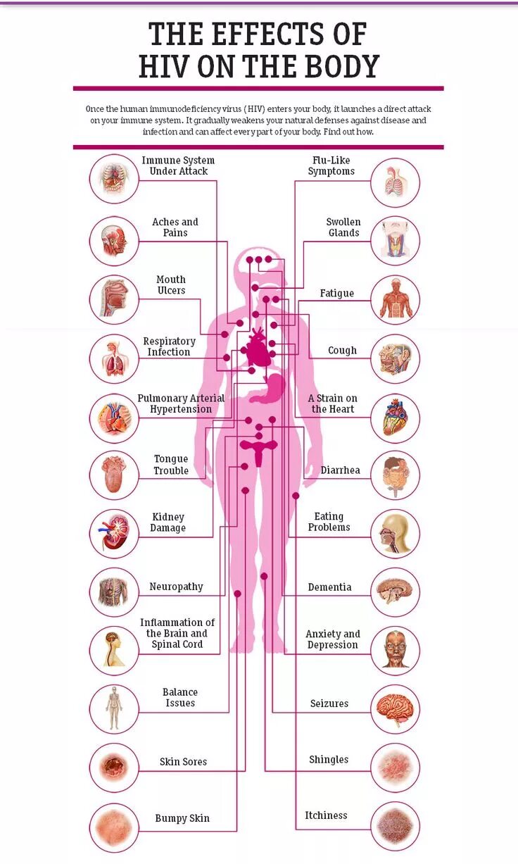 Признаки вич сыпь фото Pin on Immunology