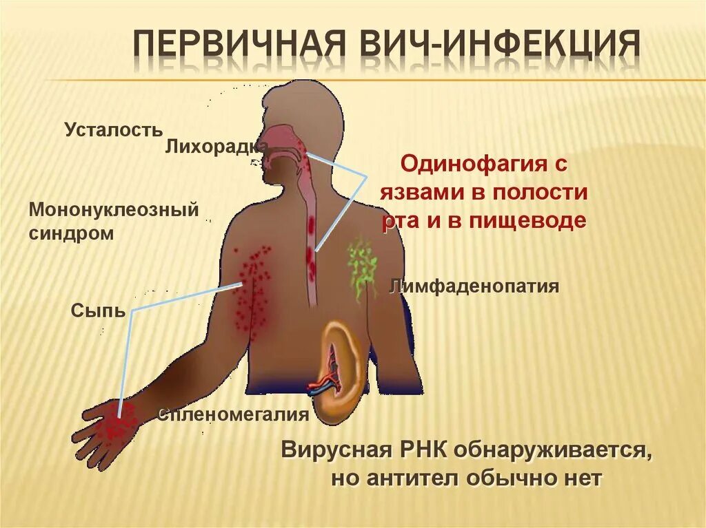 Признаки вич сыпь фото ОСНОВНАЯ ПРОБЛЕМА ИЗЛЕЧЕНИЯ ВИЧ-ИНФЕКЦИИ Медицина 2.0 Дзен