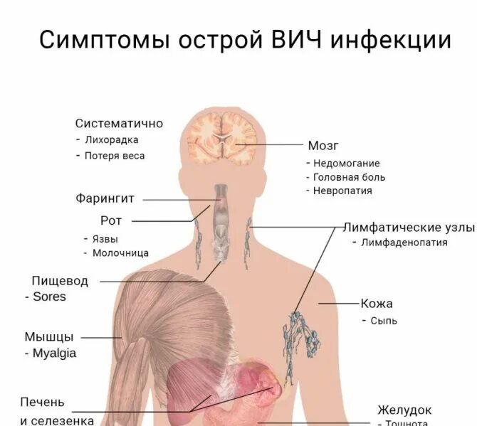 Признаки вич сыпь фото Симптомы вич инфекции на ранней стадии