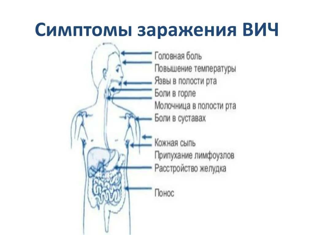 Признаки вич у мужчин фото симптомы PPT - Информирован - значит, защищён PowerPoint Presentation - ID:5916639