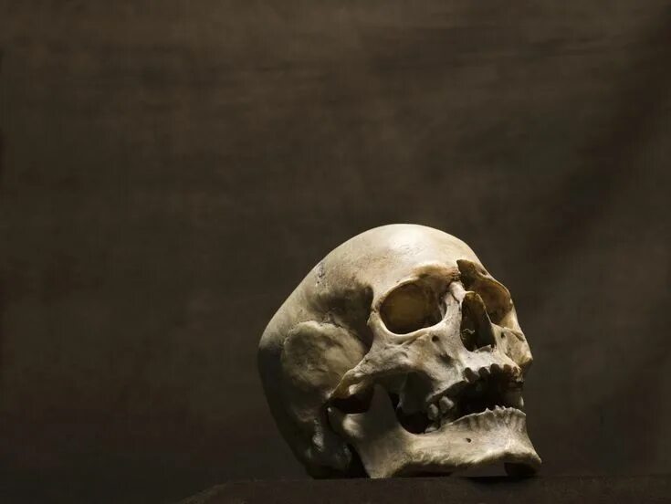 Пробитый череп фото How to Make a Human Skull Out of Clay Craneo humano, Esqueleto humano, Craneo