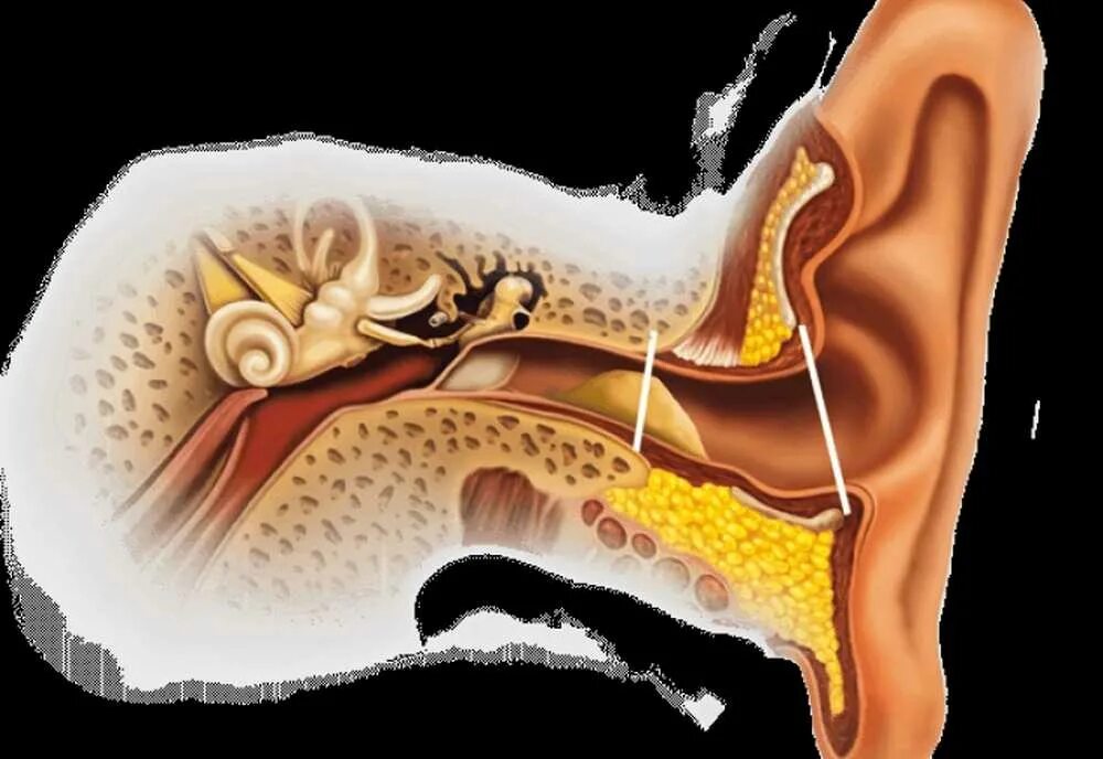 Пробка в ухе фото Сера в ушах человека