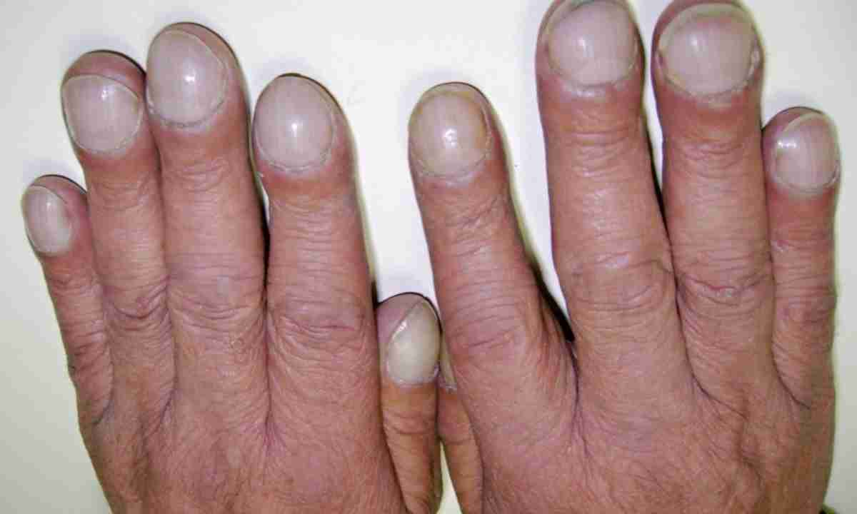 Researchers Explain What Biting Your Nails Says About Your Personality