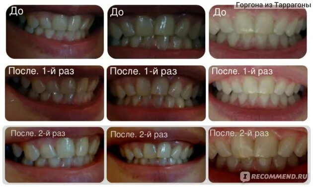 Профессиональная чистка зубов фото до и после Зубная щетка натуральная Мисвак (или сивак) - "Делаем профессиональную чистку зу