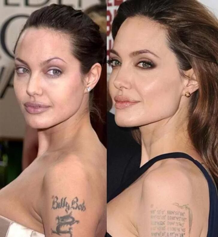 Профиль джоли фото до и после The Consequence Of Piedmont Plastic Surgery Angelina Jolie Plastic Surgery Nose 