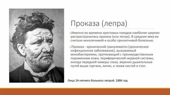 Проказа что за болезнь простыми словами фото Ежегодно 25 апреля во всем мире отмечают день борьбы с малярией.... Интересный к