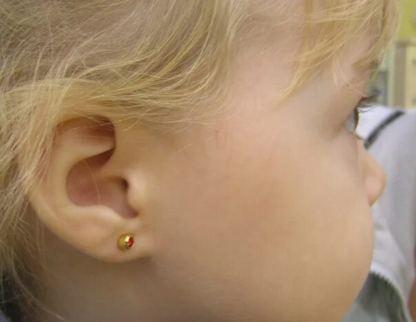 Прокол ушей фото детей Ear piercing Modern cosmetology has well-established means for painless and safe