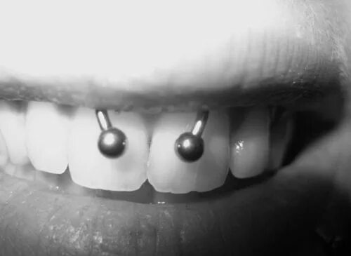 Прокол уздечки верхней фото Pin on Pierced Up Piercing tattoo, Stud earrings, Tattoos