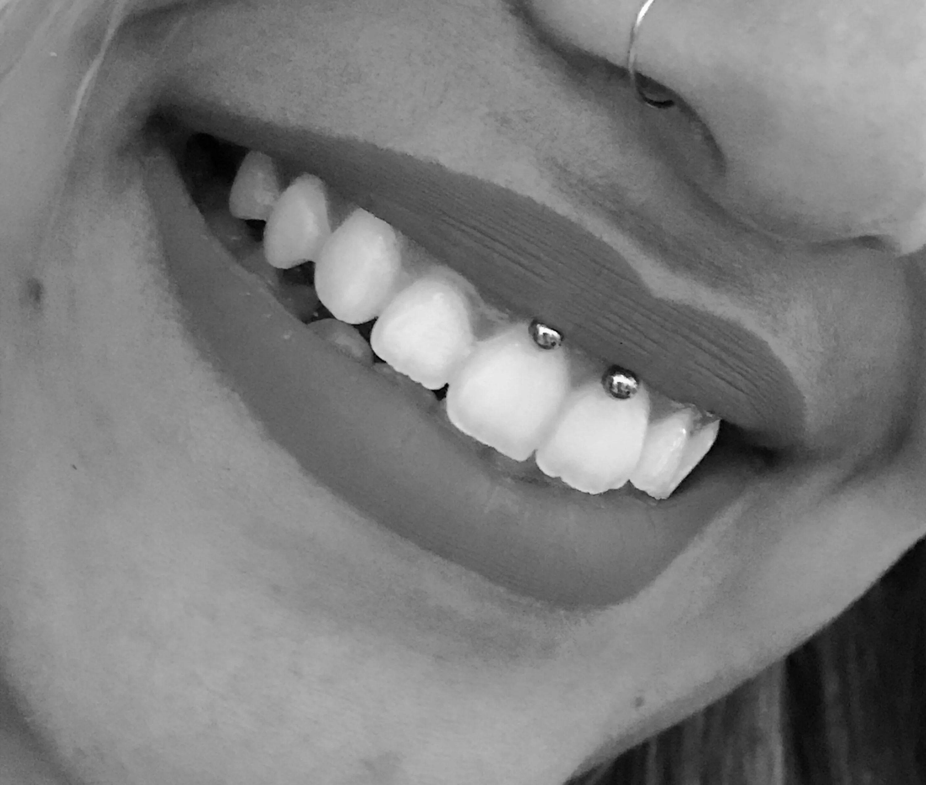 Прокол уздечки верхней фото Smiley piercing Smiley piercing, Piercing tattoo, Lip piercing