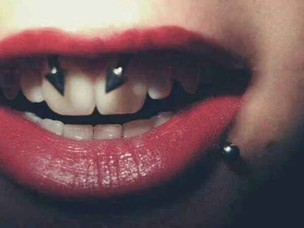 Прокол уздечки верхней фото 100+ Smiley Piercing Examples, Jewelry And FAQ’s awesome Smiley piercing, Pierci