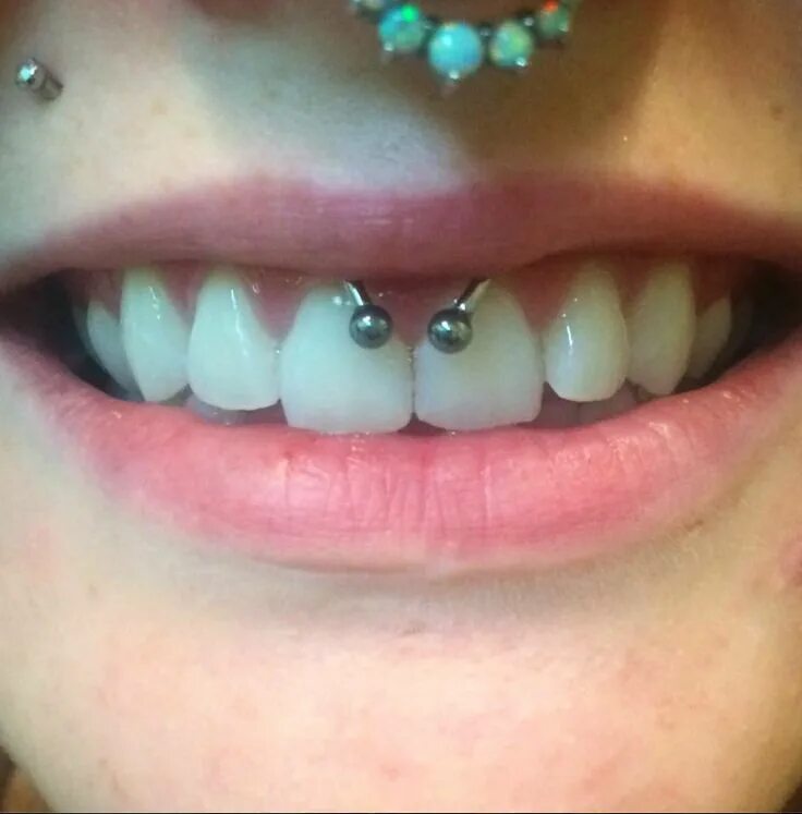 Прокол уздечки верхней фото Fresh smiley piercing by @mollymoonpierce #920tattoocompany #920tattooco #920tat