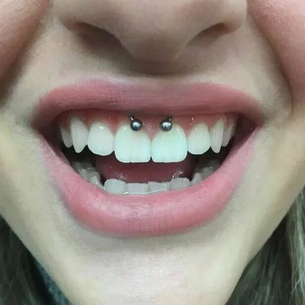 Прокол уздечки верхней фото @rennikvt Piercings, Mouth piercings, Smiley piercing