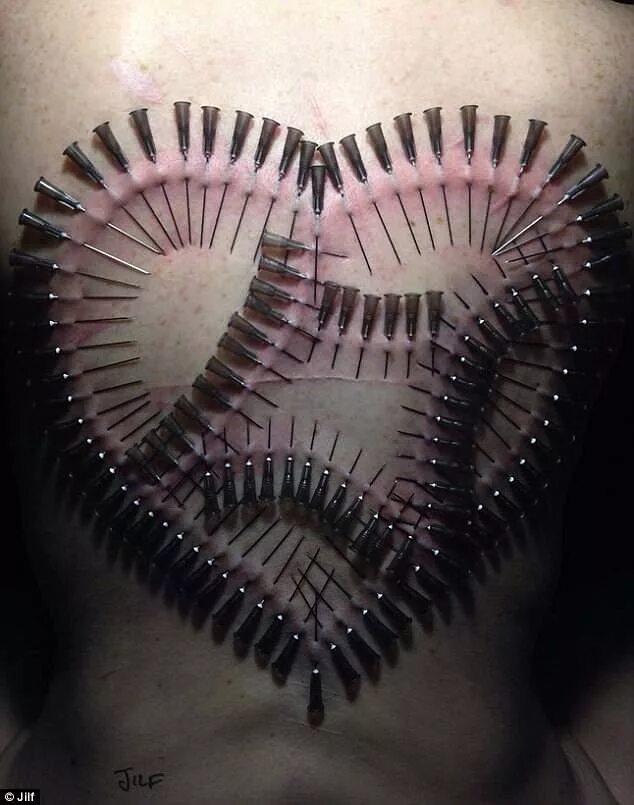 Проколола сердце шпилькой фото в ленту Melbourne BDSM needleplay top Jilf stuck 4,7000 needles into her partner Daily M