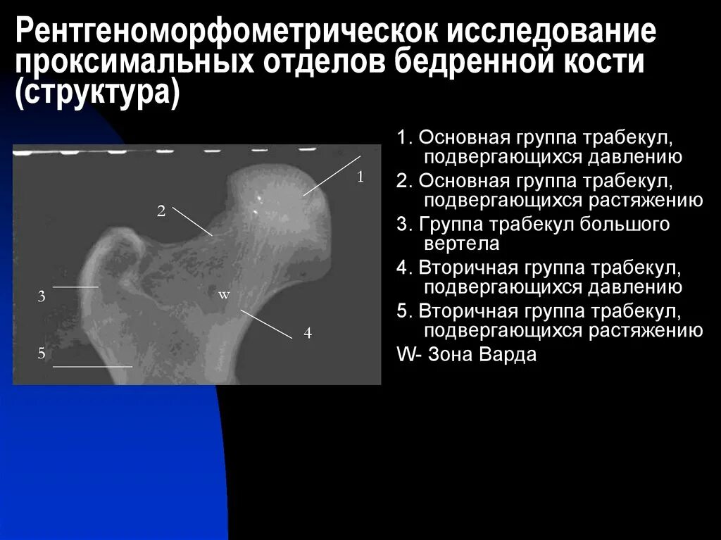 Проксимальный отдел бедренной кости фото Оценка прочности проксимальных отделов бедренной кости при рентгенодиагностическ