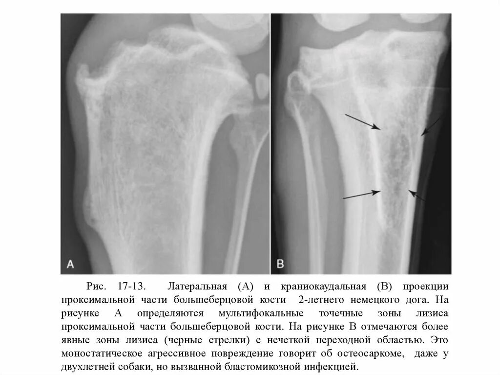 Проксимальный отдел большеберцовой кости фото Рентгенологические признаки опухолей кости и костной инфекции - презентация онла