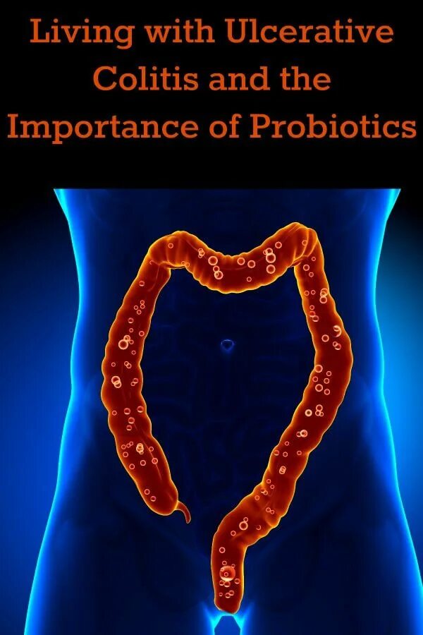 Проктит фото снаружи Living with Ulcerative Colitis and the Importance of Probiotics - Life Made Full