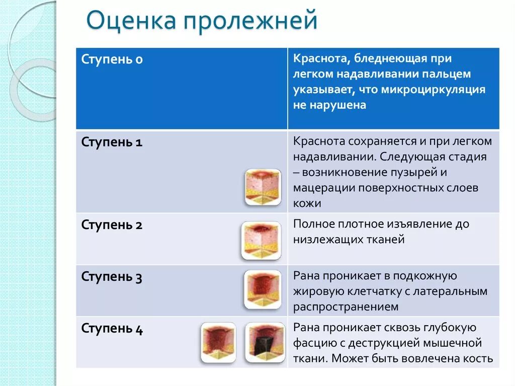 Пролежни 4 стадии фото Задача пролежни - найдено 55 картинок